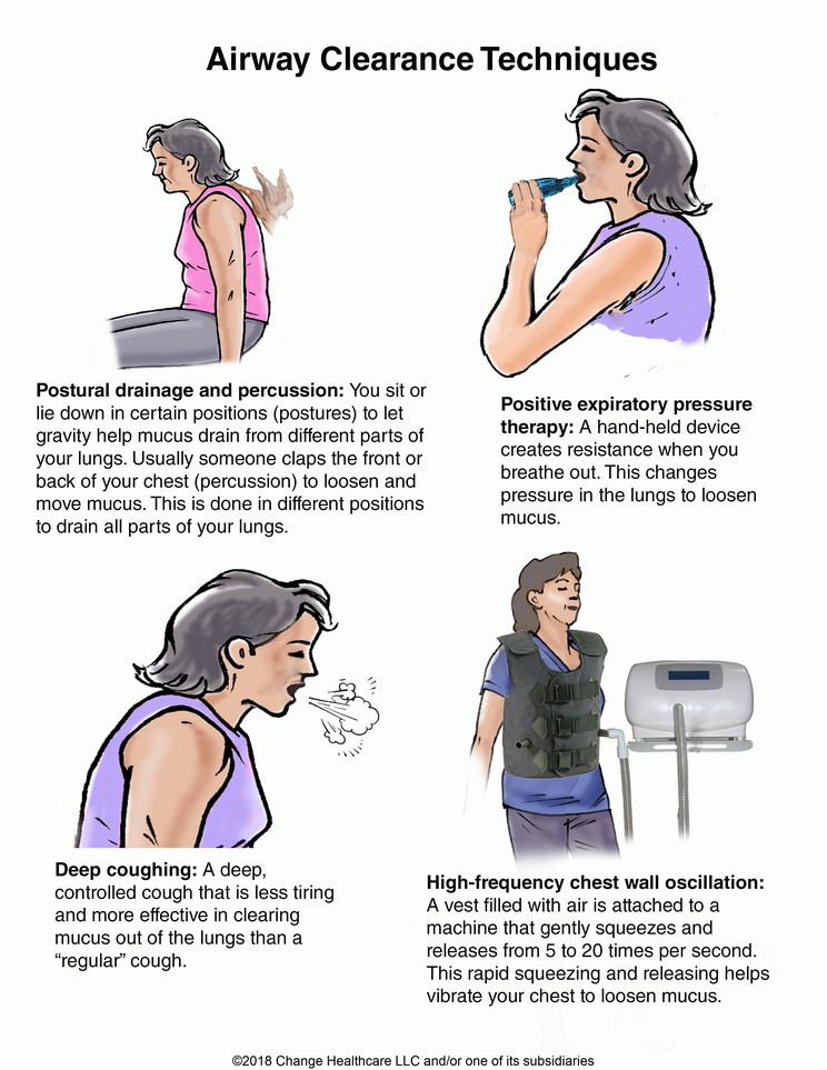 Airway Clearance Techniques: Illustration