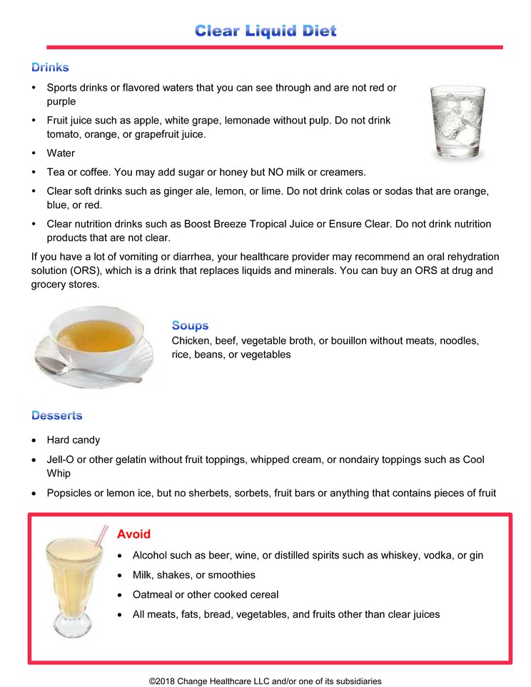 Clear Liquid Diet: Checklist