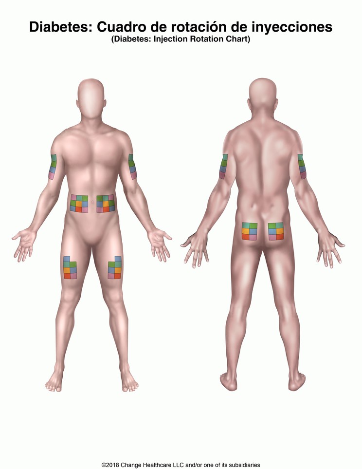 Diabetes: Injection Rotation Chart: Illustration