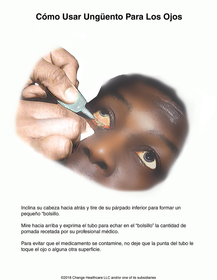 How to Use Eye Ointment: Illustration