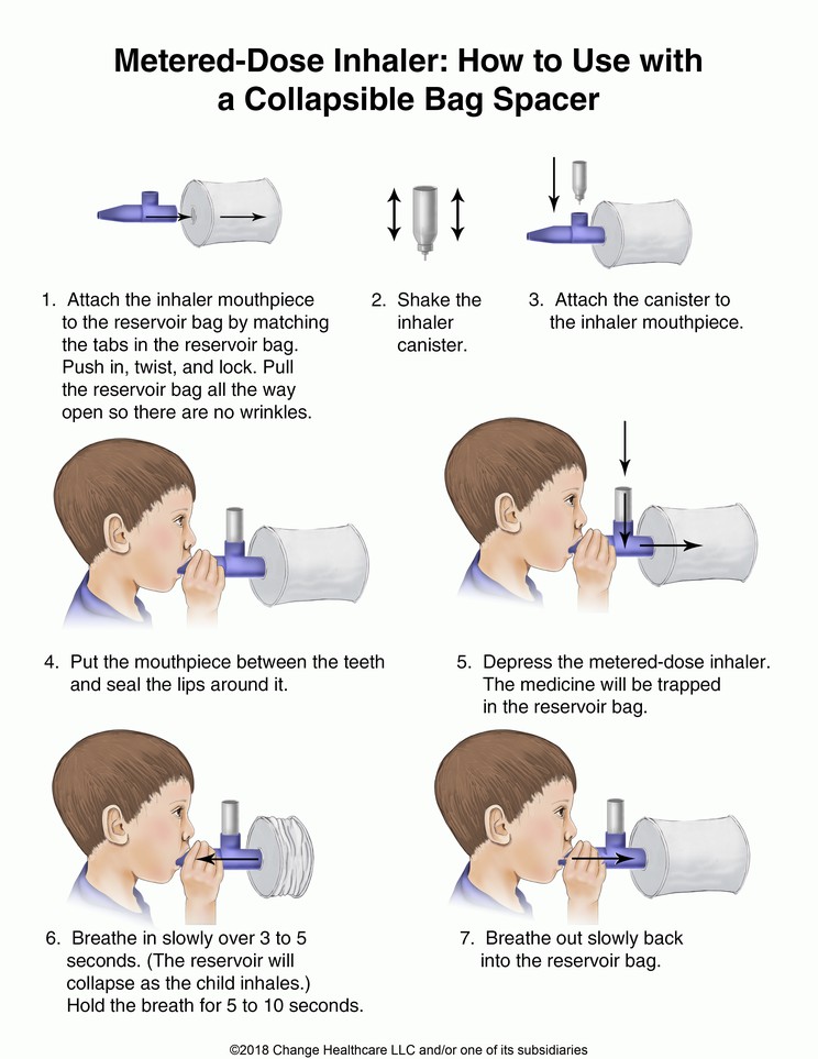 Metered-Dose Inhaler, How to Use with a Collapsible Bag Spacer: Illustration