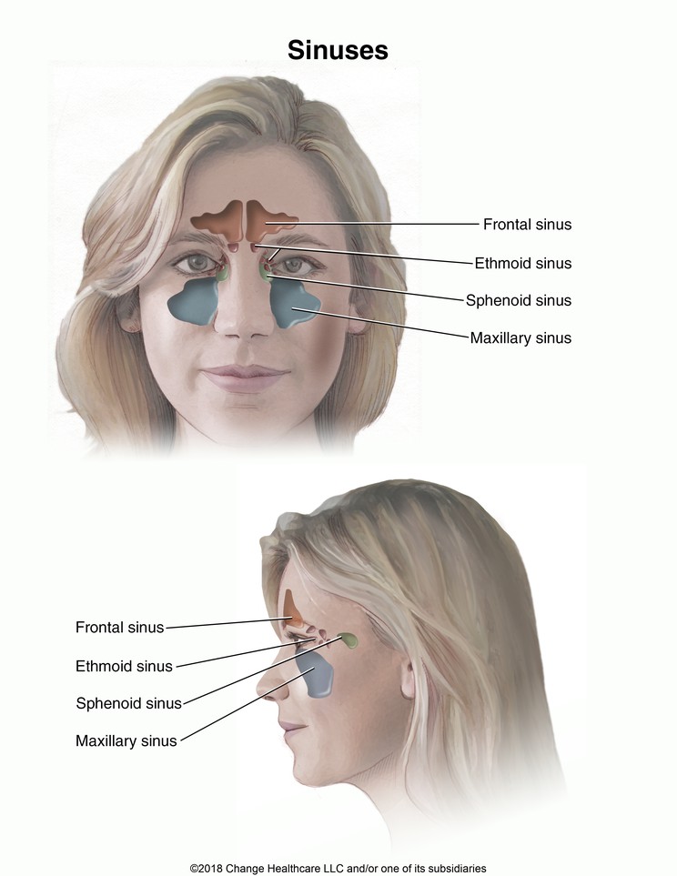 Sinuses: Illustration