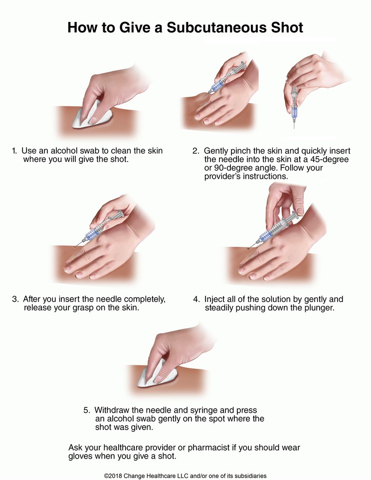 Subcutaneous Shot, How to Give: Illustration