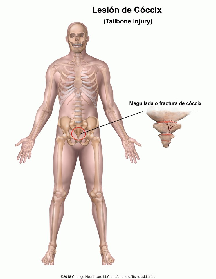 Tailbone Injury: Illustration