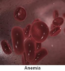 Thumbnail image of: Anemia: Animation