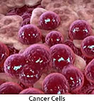 Thumbnail image of: Cancer Cell Growth: Animation