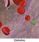 Thumbnail image of: Diabetes: Animation