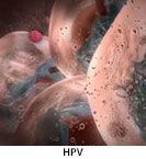 Thumbnail image of: Human Papillomavirus (HPV): Animation