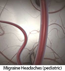 Thumbnail image of: Migraine Headaches (pediatric): Animation