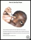 Thumbnail image of: Eyedrops, How to Put in Eye: Illustration