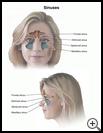 Thumbnail image of: Sinuses: Illustration