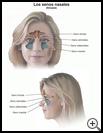 Thumbnail image of: Sinuses: Illustration