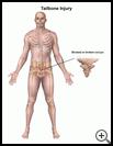 Thumbnail image of: Tailbone Injury: Illustration