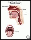 Thumbnail image of: Tonsils and Adenoids: Illustration