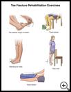 Thumbnail image of: Toe Fracture Exercises: Illustration