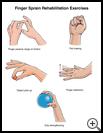 Thumbnail image of: Finger Sprain Exercises: Illustration