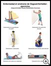 Thumbnail image of: Osgood-Schlatter Disease Exercises: Illustration, page 1