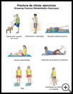 Thumbnail image of: Kneecap Fracture Exercises: Illustration, page 1