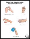 Thumbnail image of: Mallet Finger (Baseball Finger) Exercises: Illustration