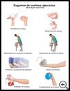 Thumbnail image of: Wrist Sprain Exercises: Illustration