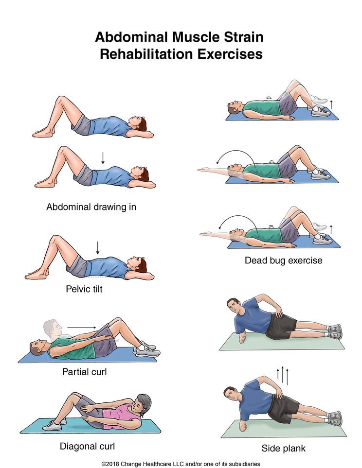 Abdominal Muscle Strain Exercises: Illustration