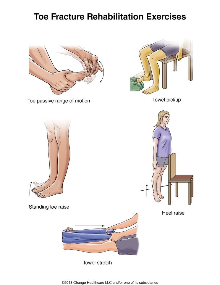Toe Fracture Exercises: Illustration