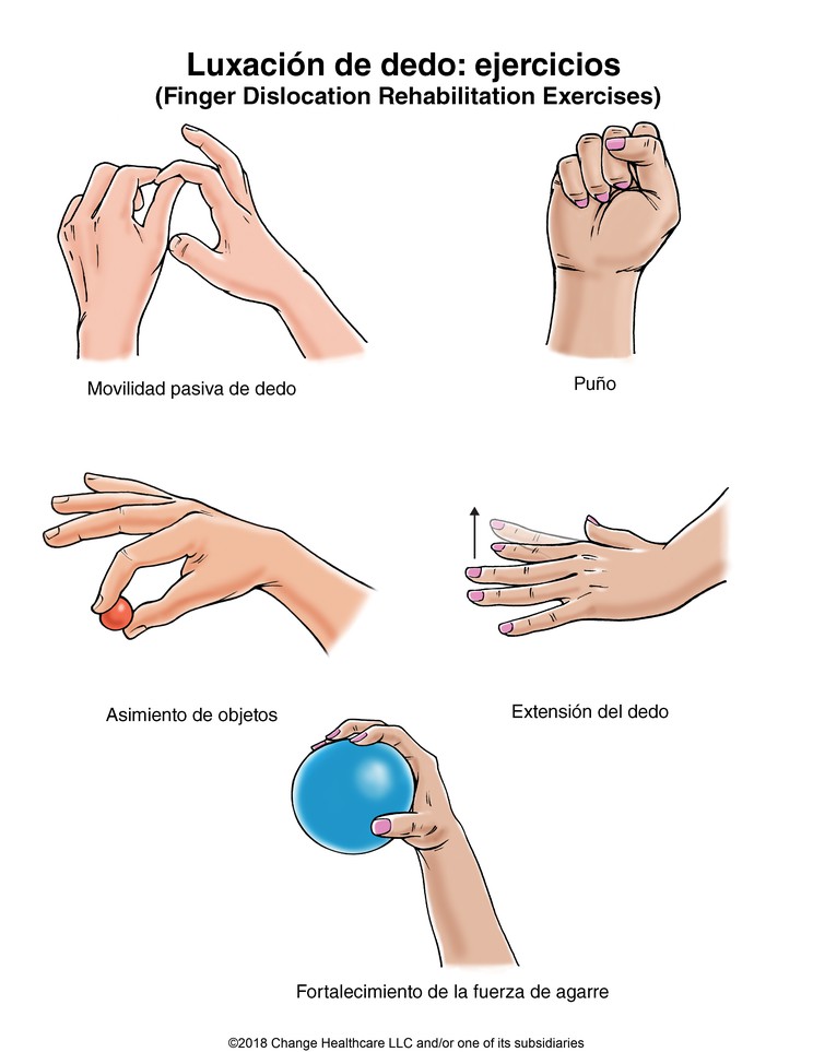 Finger Dislocation Exercises: Illustration