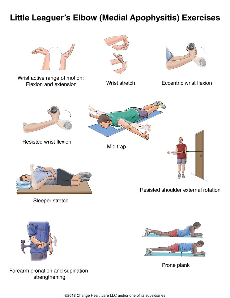 Little Leaguer's Elbow (Medial Apophysitis) Exercises: Illustration