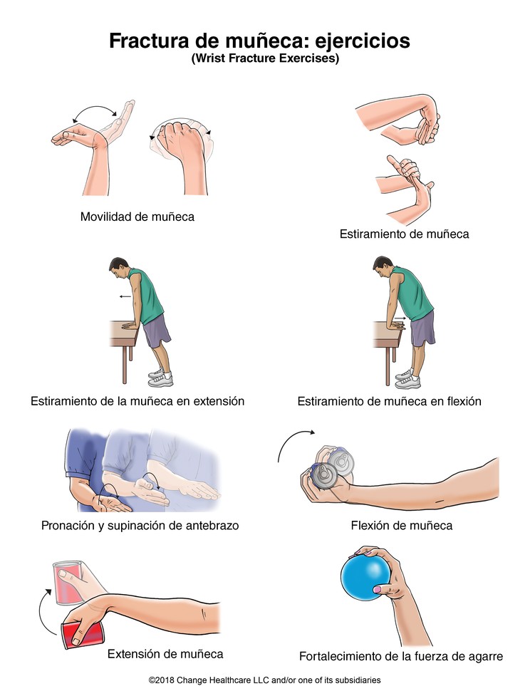 Wrist Fracture Exercises: Illustration
